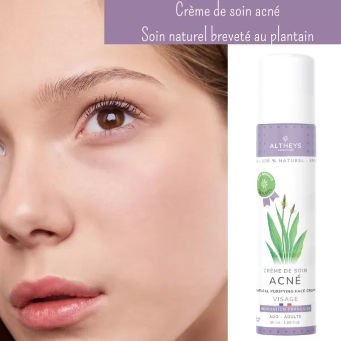 Crème anti acné pour traiter les imperfections et boutons