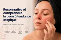 Reconnaître et comprendre la peau à tendance atopique